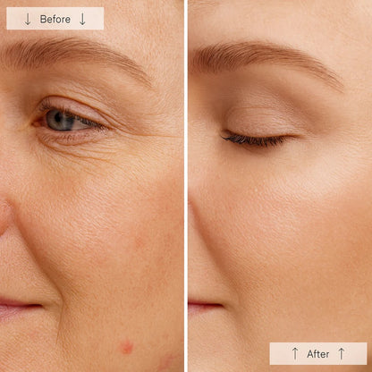 Aurora™ Glow Pro Red Light Mask